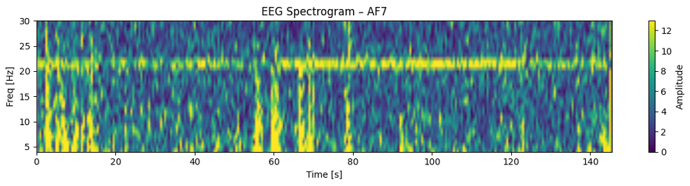 実験2-1：100マス計算中のEEGスペクトログラム