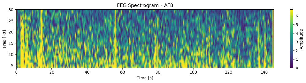 実験2-1：100マス計算中のEEGスペクトログラム