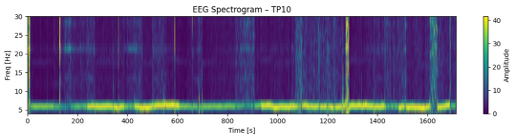 文学タスク時のEEGパターン