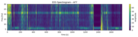 文学タスク時のEEGパターン