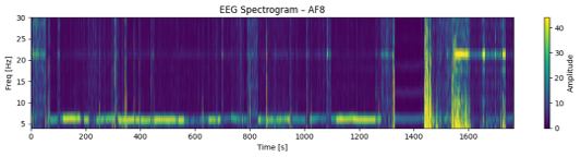 文学タスク時のEEGパターン